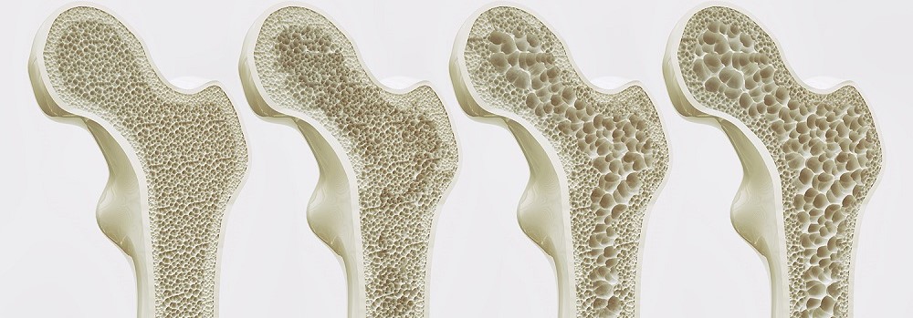 Bone Healthy Tips that keep your bones strong - Healthy Bone Tips