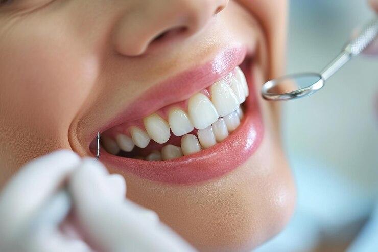 How Many Teeth Do Adults Have | Optimal Dental Health